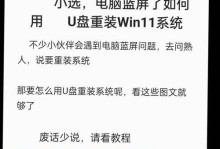 详解Wi10系统安装教程（轻松学会安装Wi10系统，让电脑焕发新生）